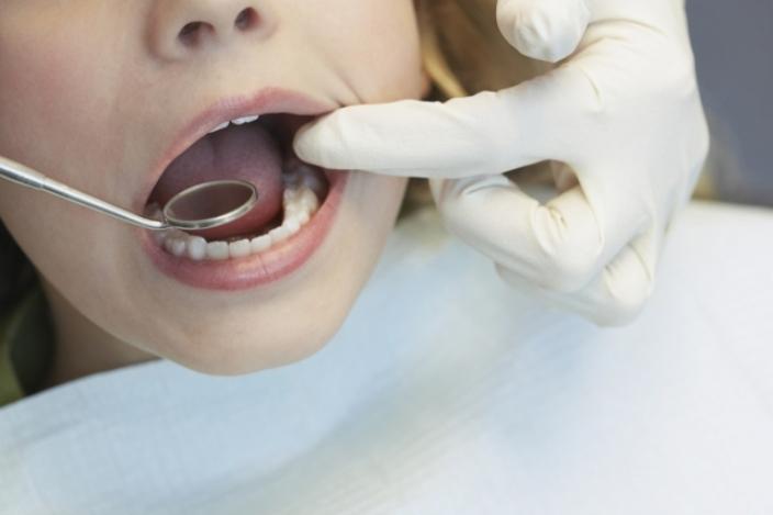 Iάπωνες ερευνητές ανακάλυψαν «το όνειρο κάθε οδοντίατρου», ένα φάρμακο που επιτρέπει την ανάπτυξη δοντιών που δεν βγήκαν ποτέ ή έχουν χαθεί